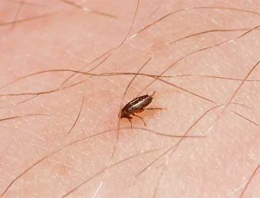 Dedetização de Pulgas na Vila Perus